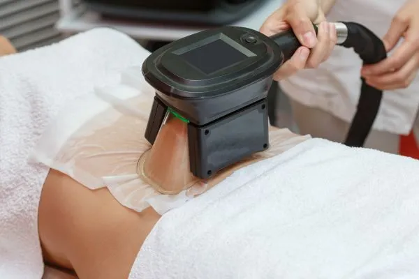 Image of person having fat freezing treatment to help weight gain Maldon