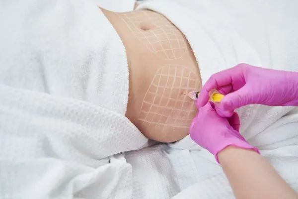 image of fat dissolving injections on love handles to help combat weight gain Maldon