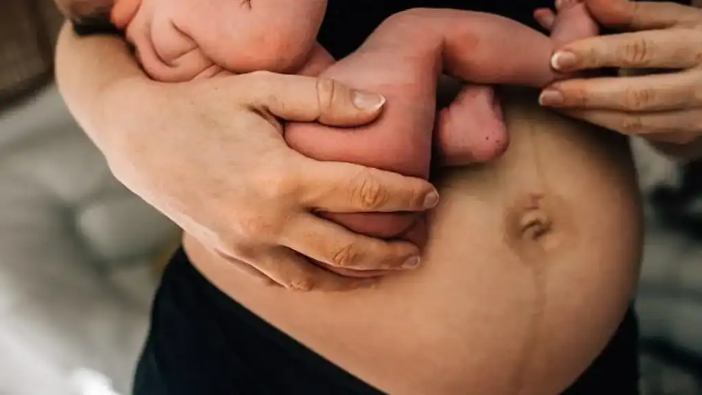 Why Is My Stomach Still Big After Pregnancy Maldon?